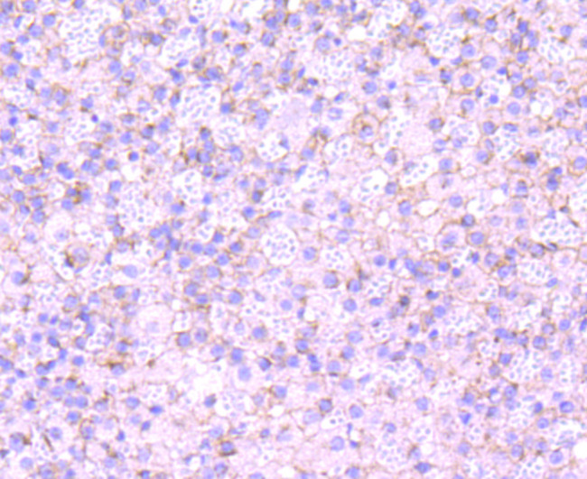 Clathrin Heavy Chain Antibody in Immunohistochemistry (Paraffin) (IHC (P))