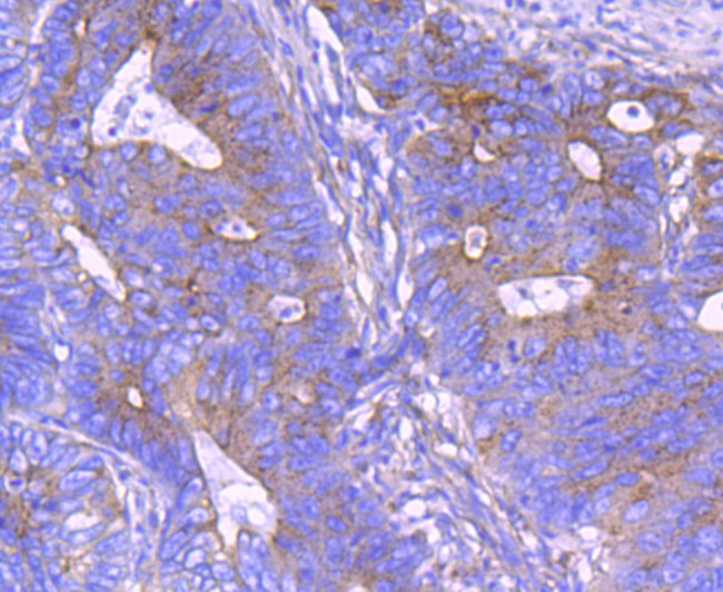 Clathrin Heavy Chain Antibody in Immunohistochemistry (Paraffin) (IHC (P))