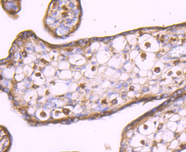 LXR alpha Antibody in Immunohistochemistry (Paraffin) (IHC (P))