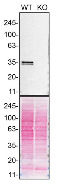 hnRNP A1 Antibody