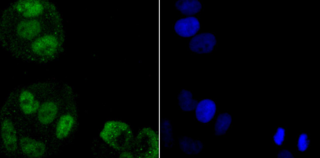 hnRNP A1 Antibody in Immunocytochemistry (ICC/IF)