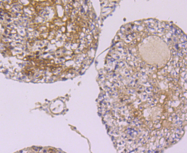 hnRNP A1 Antibody in Immunohistochemistry (Paraffin) (IHC (P))