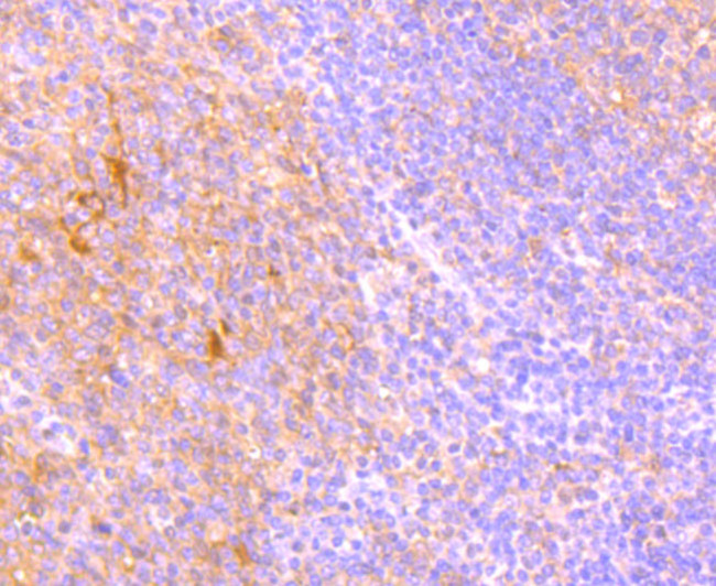 TRAIL-R2 (DR5) Antibody in Immunohistochemistry (Paraffin) (IHC (P))