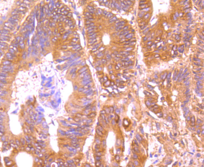 TRAIL-R2 (DR5) Antibody in Immunohistochemistry (Paraffin) (IHC (P))