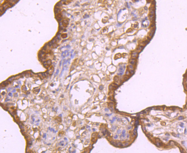 TRAIL-R2 (DR5) Antibody in Immunohistochemistry (Paraffin) (IHC (P))