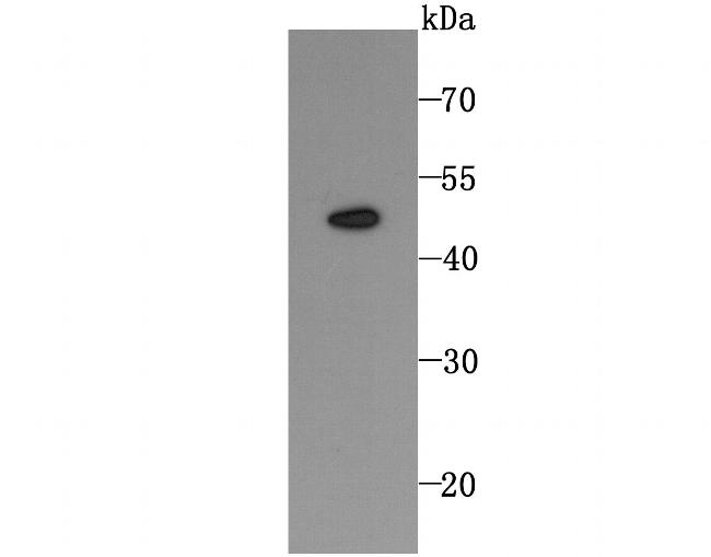 TRAIL-R2 (DR5) Antibody in Western Blot (WB)