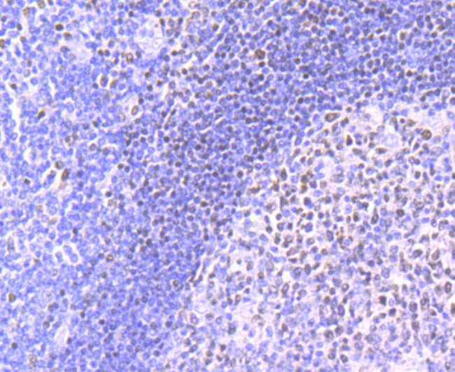 MEF2A Antibody in Immunohistochemistry (Paraffin) (IHC (P))