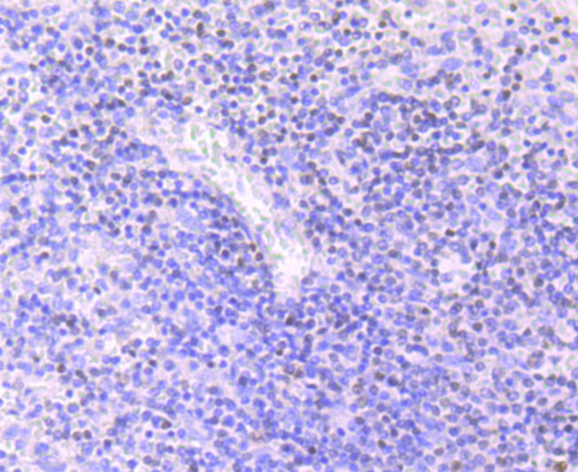 MEF2A Antibody in Immunohistochemistry (Paraffin) (IHC (P))