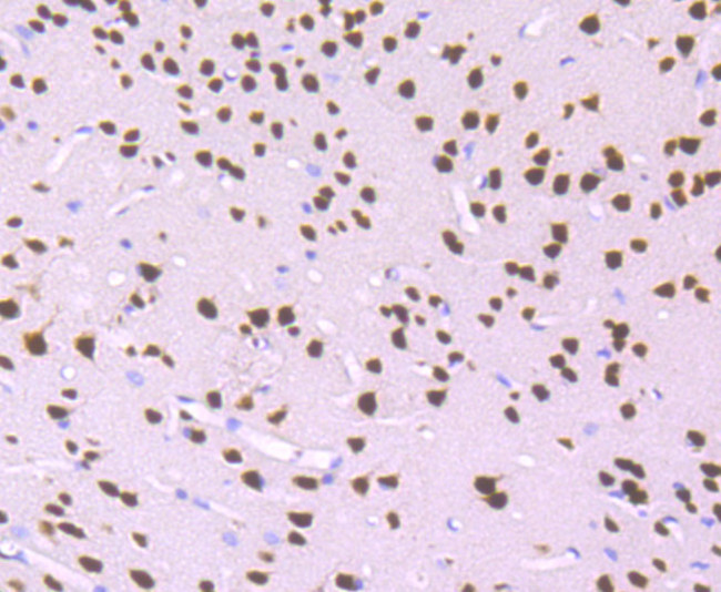 MEF2A Antibody in Immunohistochemistry (Paraffin) (IHC (P))