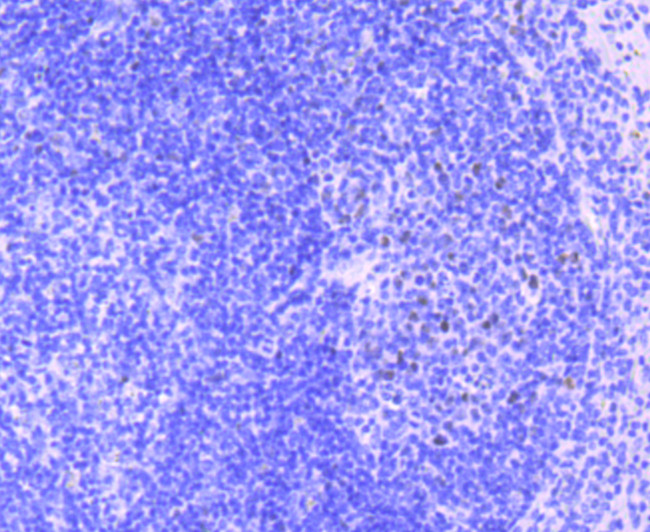 MEF2A Antibody in Immunohistochemistry (Paraffin) (IHC (P))