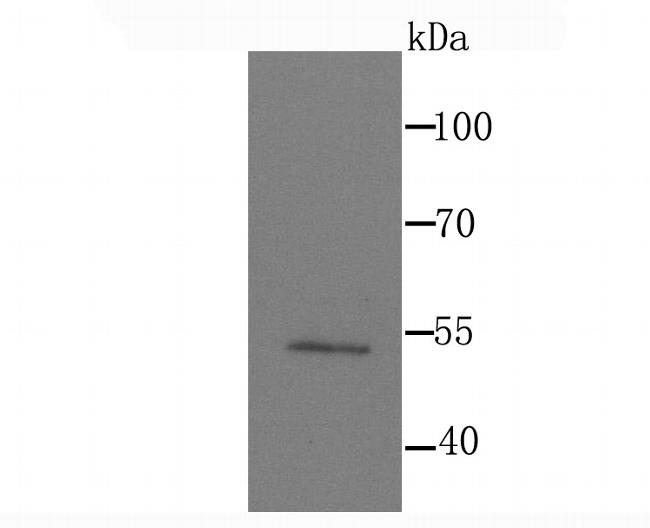 MEF2A Antibody in Western Blot (WB)