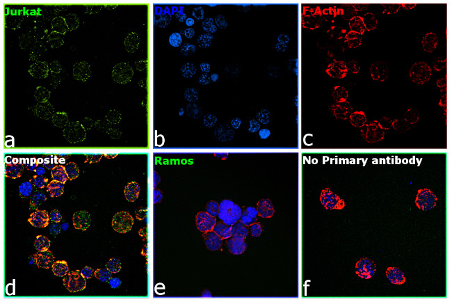 ULK1 Antibody in Immunocytochemistry (ICC/IF)