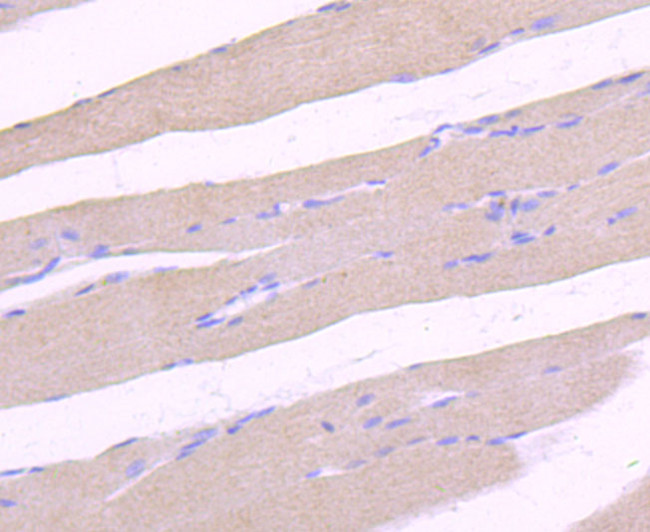 ULK1 Antibody in Immunohistochemistry (Paraffin) (IHC (P))