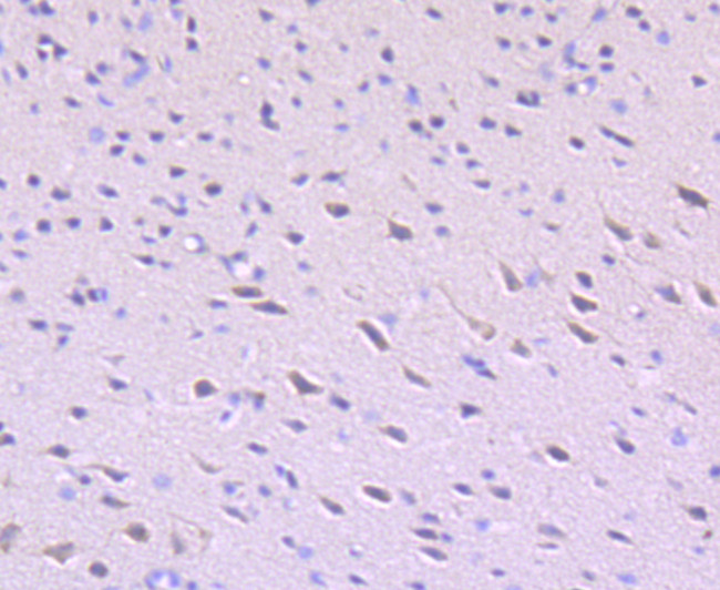 ULK1 Antibody in Immunohistochemistry (Paraffin) (IHC (P))