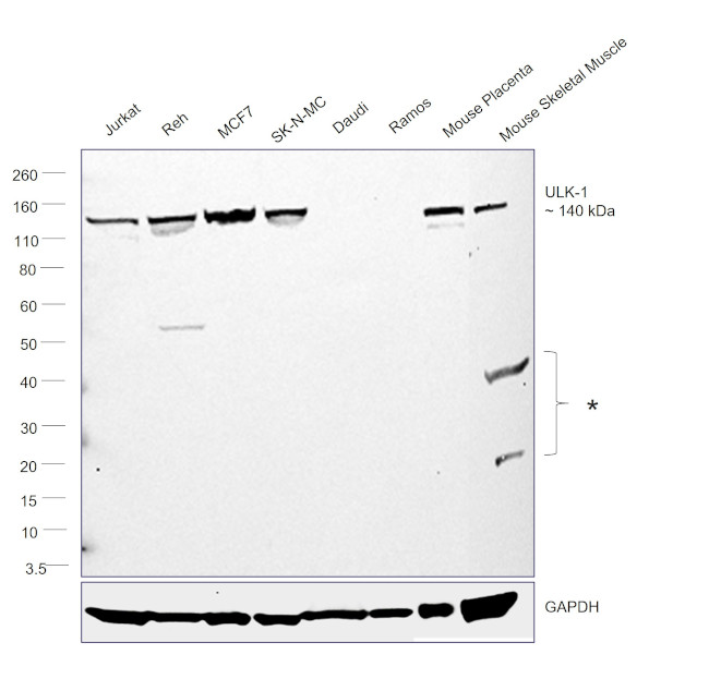 ULK1 Antibody in Western Blot (WB)