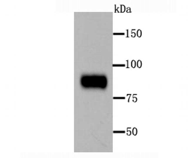 Periostin Antibody in Western Blot (WB)