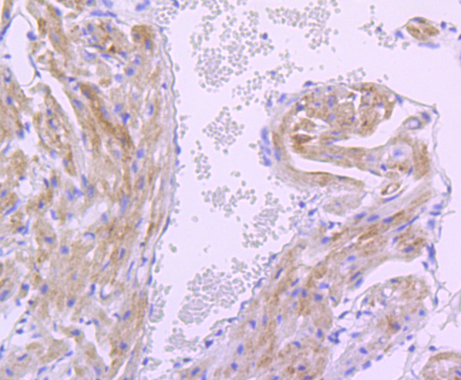 PDK1 Antibody in Immunohistochemistry (Paraffin) (IHC (P))