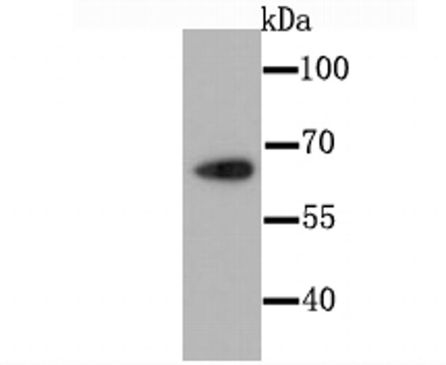 CDT1 Antibody in Western Blot (WB)