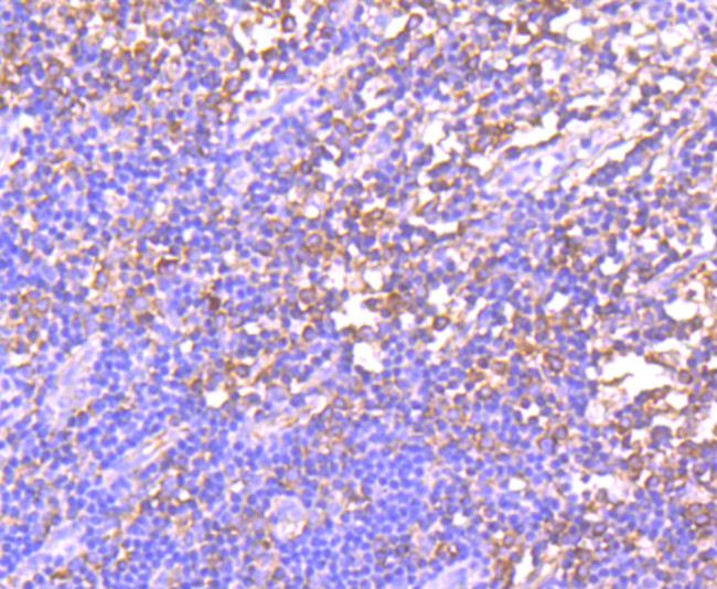 GCN2 Antibody in Immunohistochemistry (Paraffin) (IHC (P))