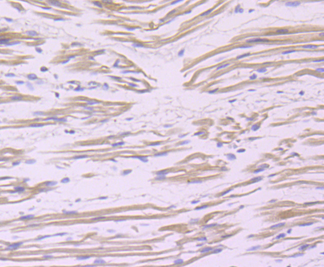 BAG3 Antibody in Immunohistochemistry (Paraffin) (IHC (P))