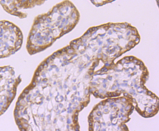 CD39 Antibody in Immunohistochemistry (Paraffin) (IHC (P))