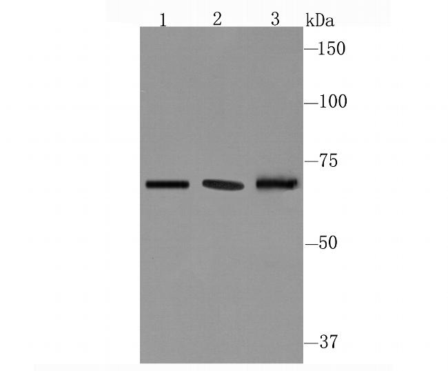 CD39 Antibody in Western Blot (WB)