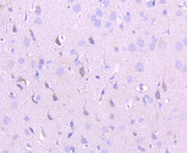 NMDAR2A Antibody in Immunohistochemistry (Paraffin) (IHC (P))