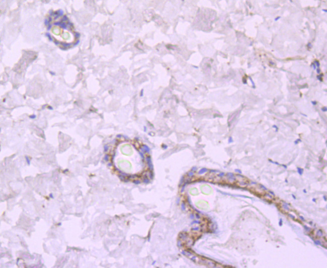 NMDAR2A Antibody in Immunohistochemistry (Paraffin) (IHC (P))