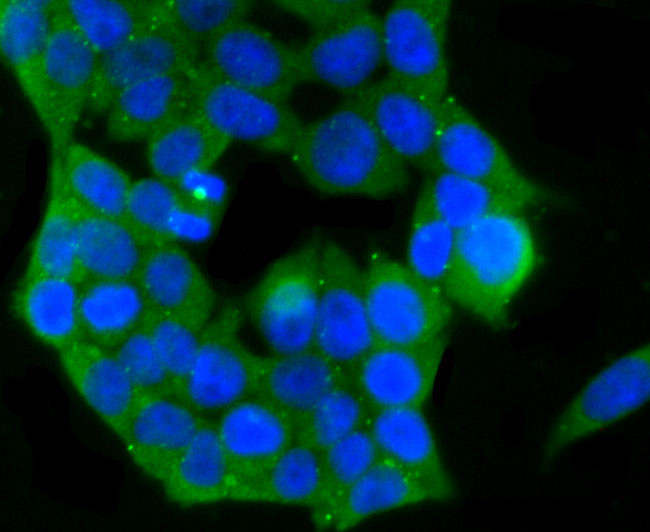 PKC epsilon Antibody in Immunocytochemistry (ICC/IF)