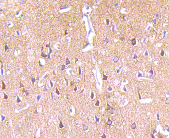 PKC epsilon Antibody in Immunohistochemistry (Paraffin) (IHC (P))