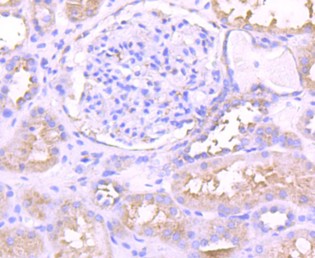 PKC epsilon Antibody in Immunohistochemistry (Paraffin) (IHC (P))