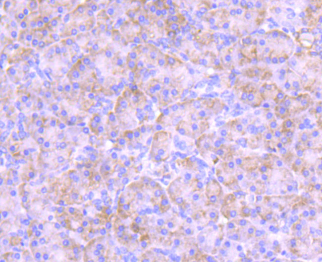 PKC epsilon Antibody in Immunohistochemistry (Paraffin) (IHC (P))