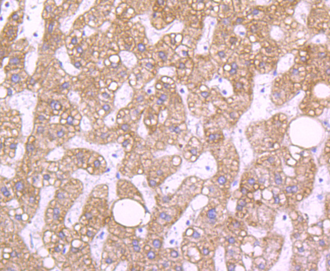 RBP4 Antibody in Immunohistochemistry (Paraffin) (IHC (P))