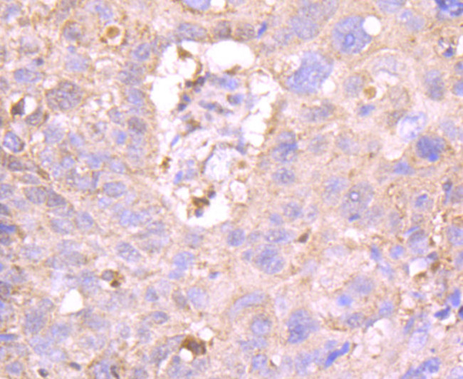 MUC4 Antibody in Immunohistochemistry (Paraffin) (IHC (P))