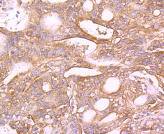 MUC4 Antibody in Immunohistochemistry (Paraffin) (IHC (P))