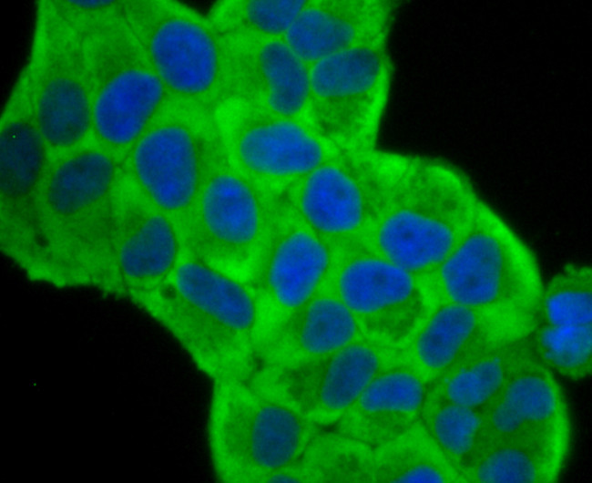 Fascin Antibody in Immunocytochemistry (ICC/IF)