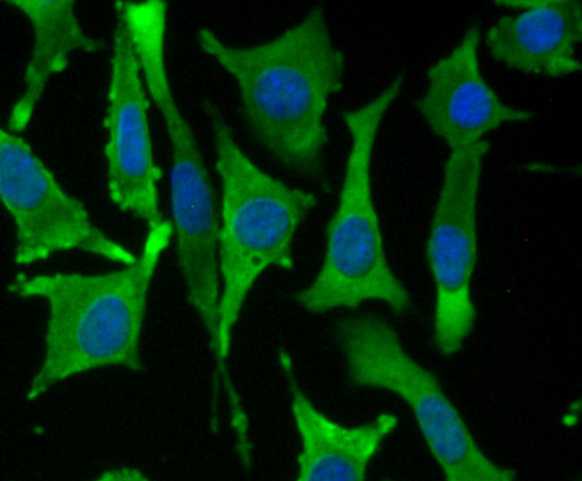 Fascin Antibody in Immunocytochemistry (ICC/IF)