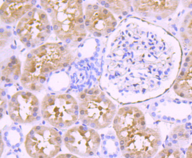 Fascin Antibody in Immunohistochemistry (Paraffin) (IHC (P))