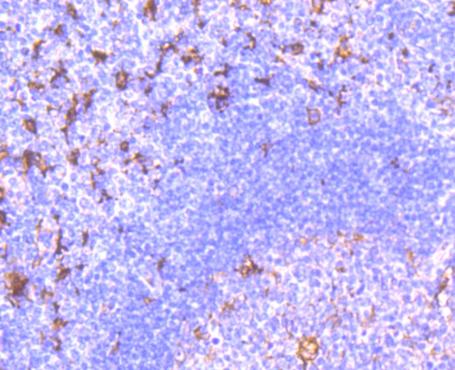 Fascin Antibody in Immunohistochemistry (Paraffin) (IHC (P))