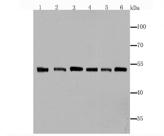 Fascin Antibody in Western Blot (WB)