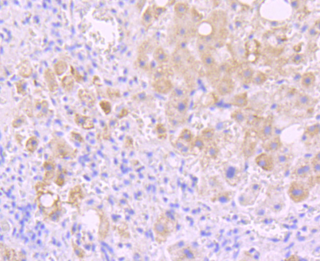 INSRR Antibody in Immunohistochemistry (Paraffin) (IHC (P))