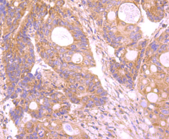 INSRR Antibody in Immunohistochemistry (Paraffin) (IHC (P))