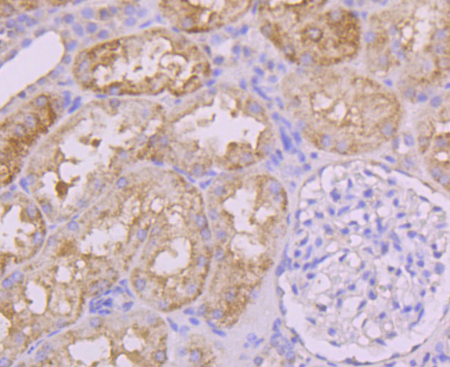 INSRR Antibody in Immunohistochemistry (Paraffin) (IHC (P))