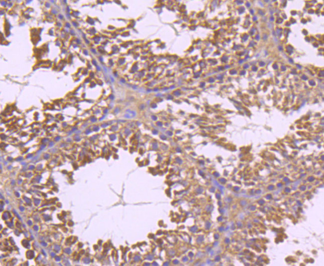 INSRR Antibody in Immunohistochemistry (Paraffin) (IHC (P))