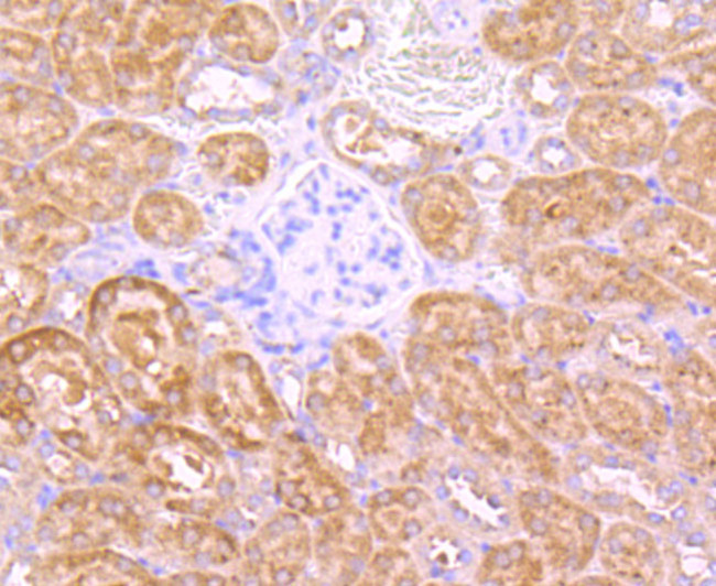 INSRR Antibody in Immunohistochemistry (Paraffin) (IHC (P))