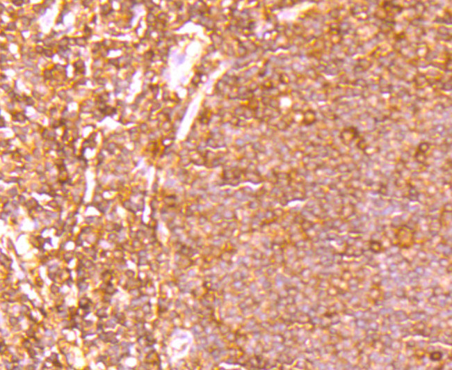 ETS1 Antibody in Immunohistochemistry (Paraffin) (IHC (P))