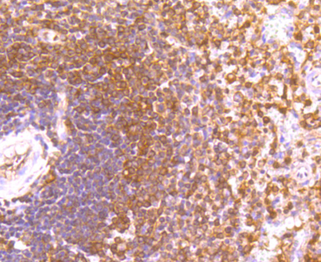 ETS1 Antibody in Immunohistochemistry (Paraffin) (IHC (P))