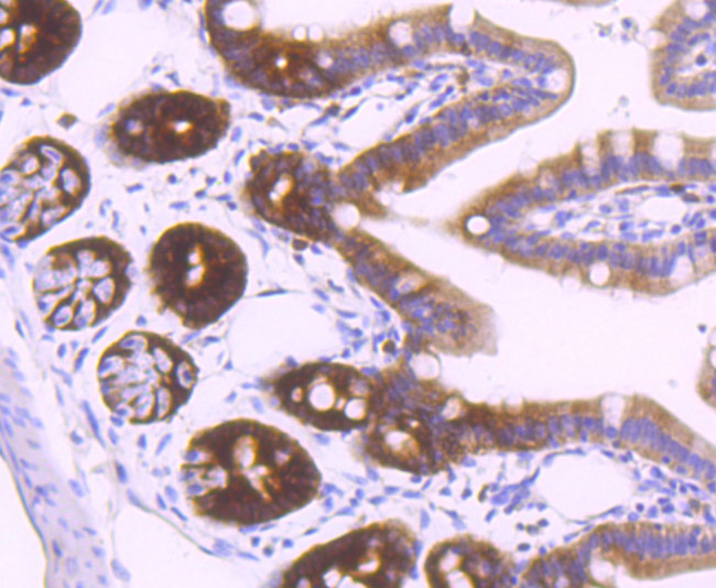 Thymidylate Synthase Antibody in Immunohistochemistry (Paraffin) (IHC (P))