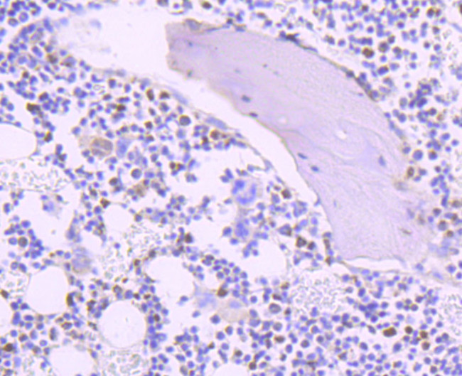 Thymidylate Synthase Antibody in Immunohistochemistry (Paraffin) (IHC (P))