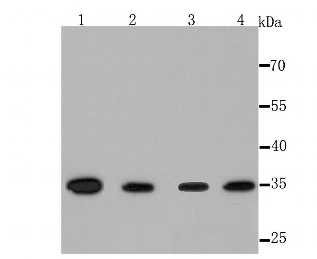 Thymidylate Synthase Antibody in Western Blot (WB)